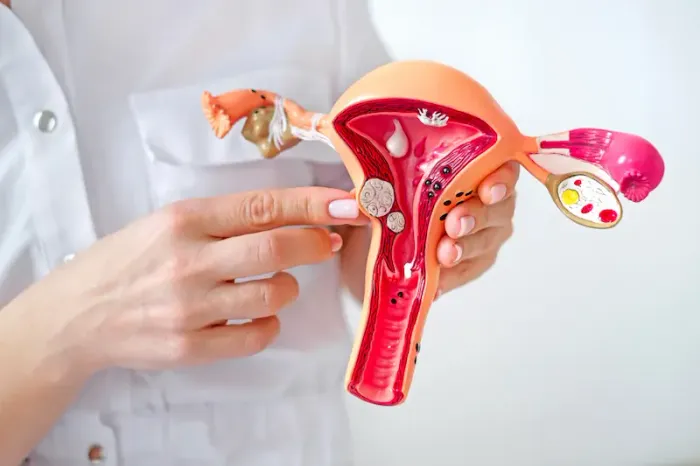 Uterine Fibroids Overview of Symptoms and Treatments